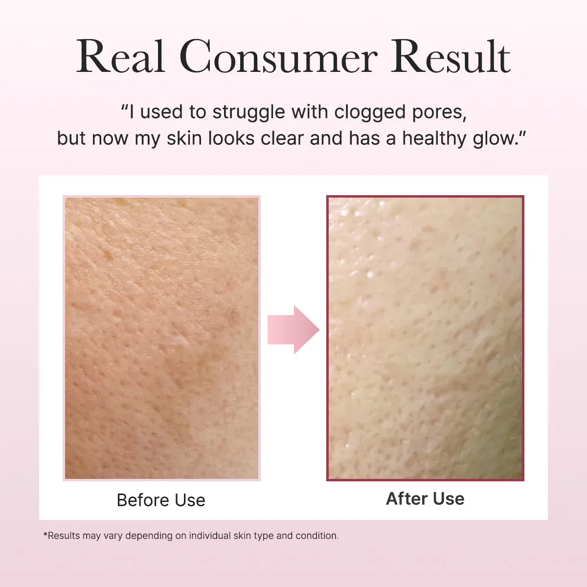 Arencia [Arencia] Fresh Rosehip Rice Mochi Cleanser 120g