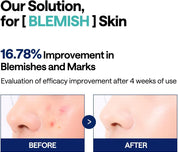Mediheal [Mediheal] Madecassocide Blemish Pad (100ea)
