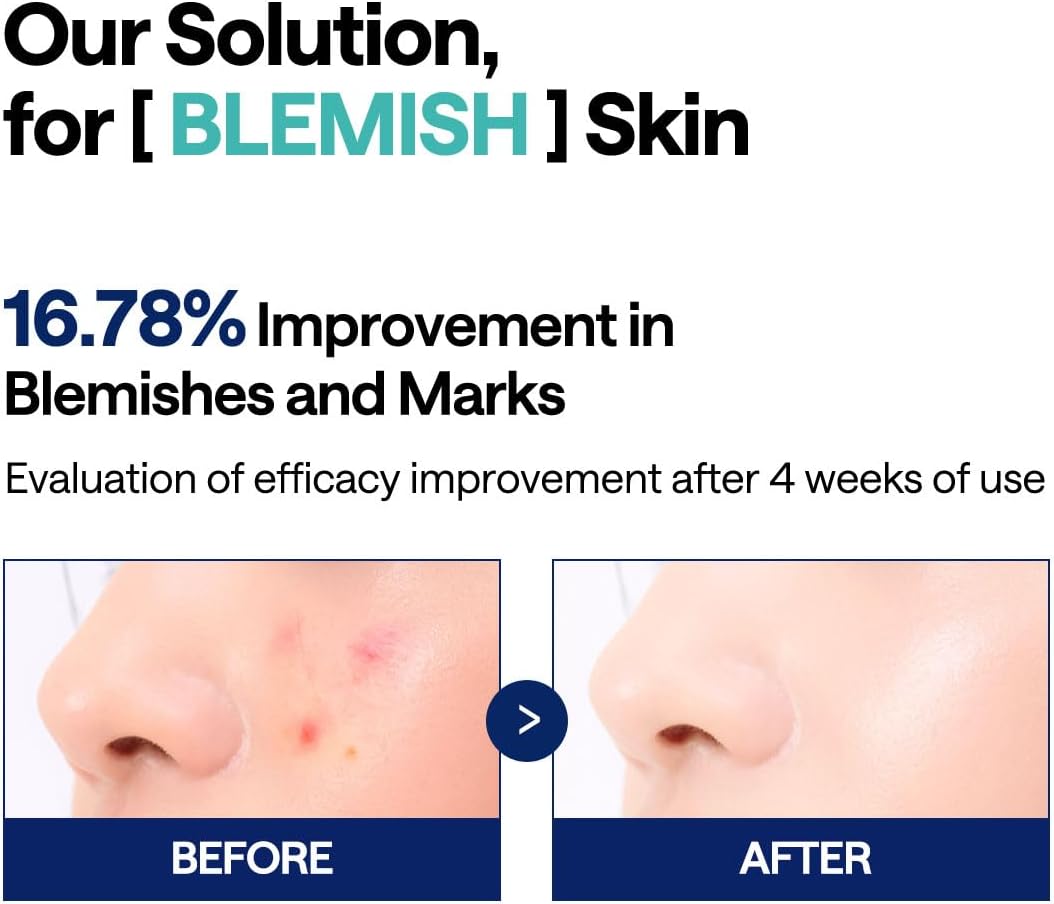 Mediheal [Mediheal] Madecassocide Blemish Pad (100ea)