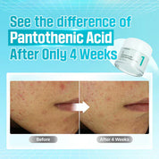 Numbuzin [numbuzin] No.1 Pantothenic B5 Active Soothing Cream 80ml