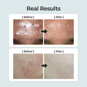 Numbuzin [numbuzin] No.1 Pure-full Calming Herb Toner 300ml