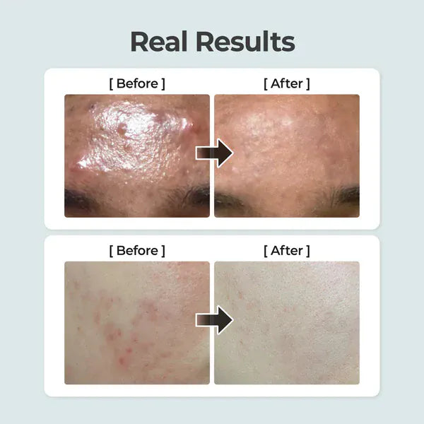 Numbuzin [numbuzin] No.1 Pure-full Calming Herb Toner 300ml