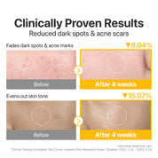 Numbuzin [numbuzin] No.5 Vitamin-Niacinamide Concentrated Pad 180ml(70Pads)