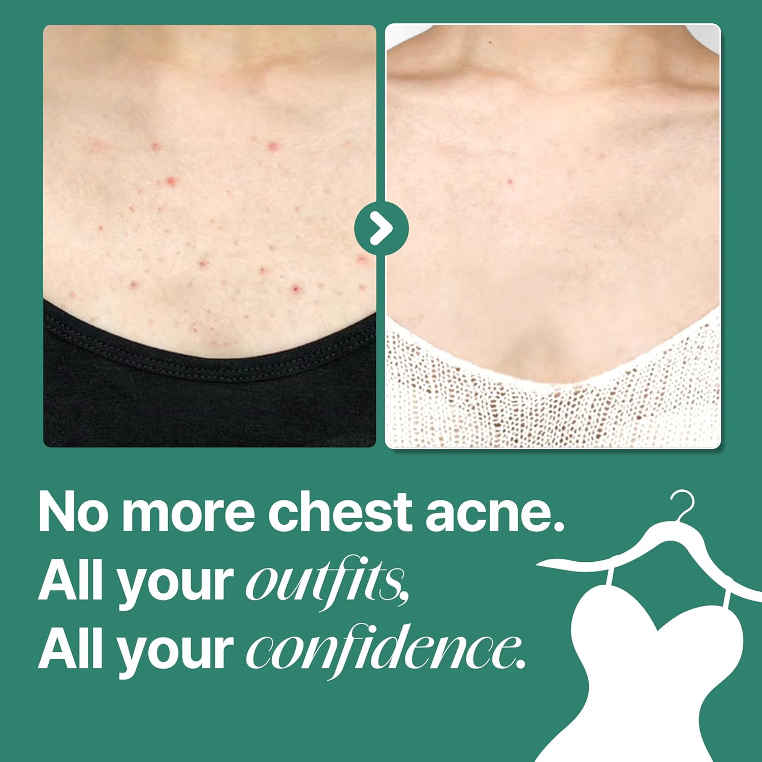 SOME BY MI AHA.BHA.PHA 30days Miracle Acne Clear Body Cleanser 400g