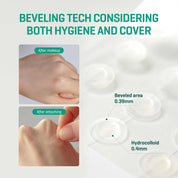 SOME BY MI Clear Spot Patch (18- Patches)