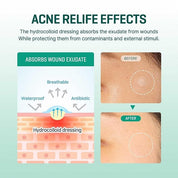 SOME BY MI Clear Spot Patch (18- Patches)