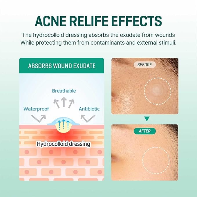 SOME BY MI Clear Spot Patch (18- Patches)