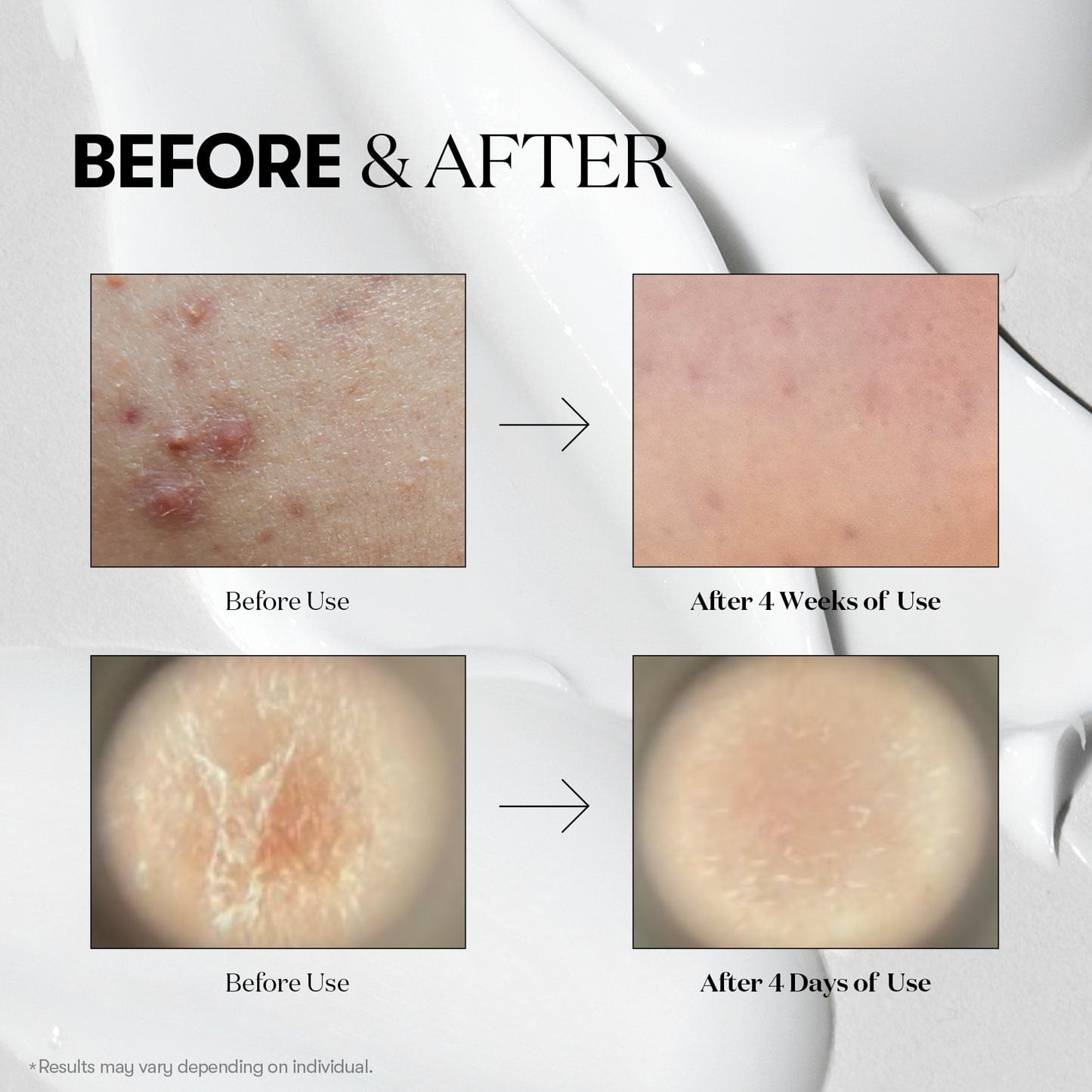 VT COSMETICS VT COSMETICS Reedle Shot 100 serum 50ml