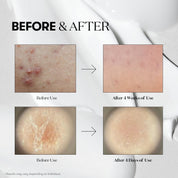 VT COSMETICS VT COSMETICS Reedle Shot 100 serum 50ml